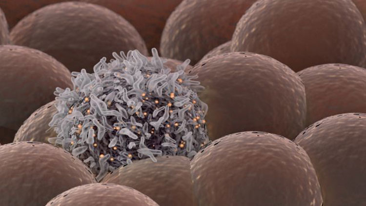 دانشمندان خبر از ابداع لیزر جدیدی داده‌اند که می‌تواند سلول‌های سرطانی در خون را پیدا و نابود کند