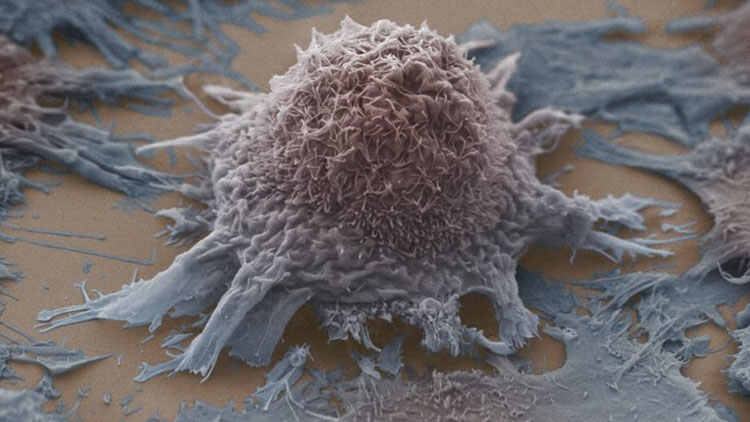 سلول‌های سرطانی که از گرسنگی مشرف به مرگ هستند می‌توانند رشد تومور را متوقف کنند