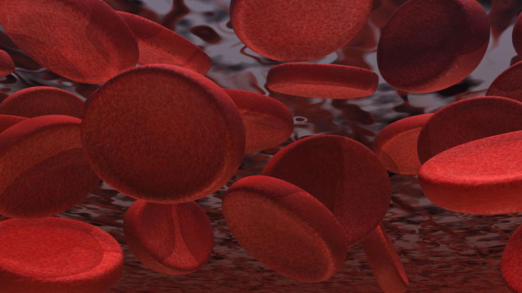 درمان کم‌خونی ماکروسیتیک؛ در این کم‌خونی گلبول‌های قرمز بزرگ می‌شوند