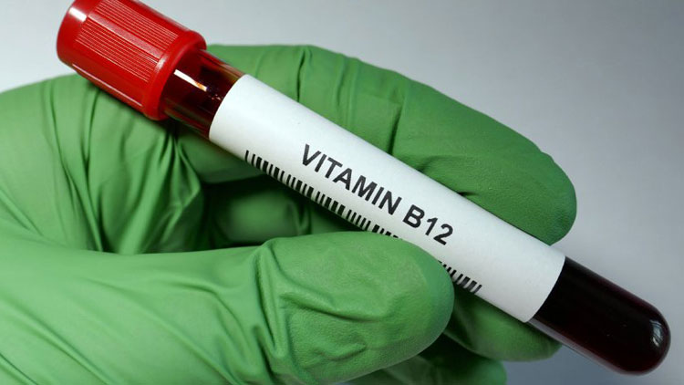 ۱۳ زنگ خطر کمبود ویتامین B12 که باید بشناسید