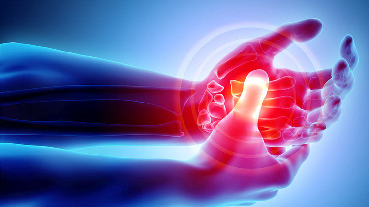 درمان نویدبخش برای آرتروز دست در مراحل اولیه