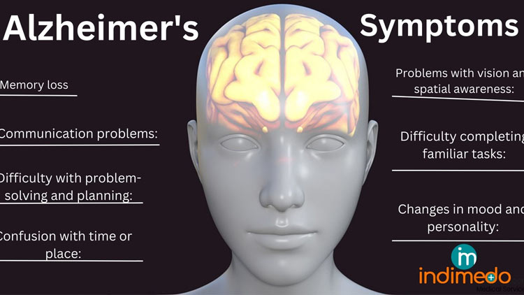 بیماری آلزایمر‌: تعریف، علل، تشخیص و درمان