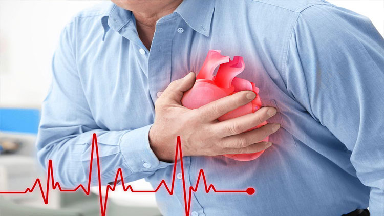 ۳ پرسش شایع درباره حمله قلبی‌